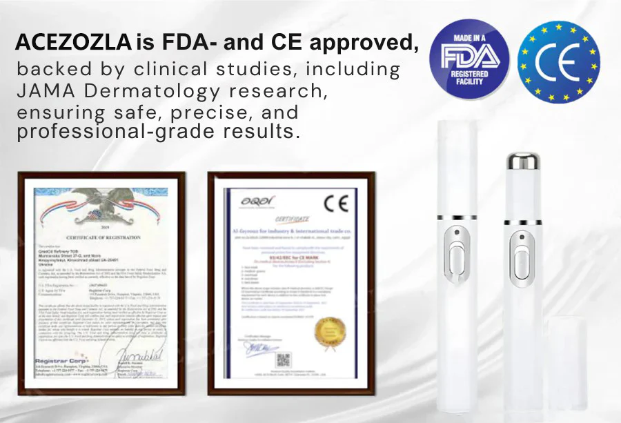 ACEZOZLA™ non-invasive laser pen delivers hospital-grade results at home