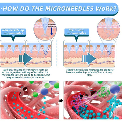 3【Genuine Preferred🥇】 – Gentle Patches GLP-1 🇺🇸 Clinically Inspired • GLP-1 Receptor Agonist Patch • 24/7 Steady Release