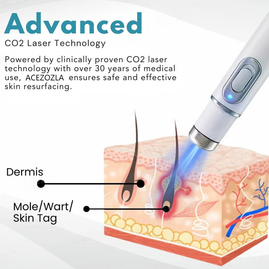 ACEZOZLA™ non-invasive laser pen delivers hospital-grade results at home