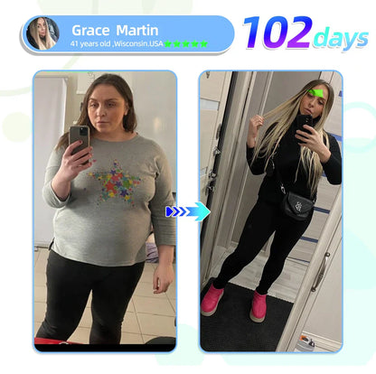 3【Genuine Preferred🥇】 – Gentle Patches GLP-1 🇺🇸 Clinically Inspired • GLP-1 Receptor Agonist Patch • 24/7 Steady Release